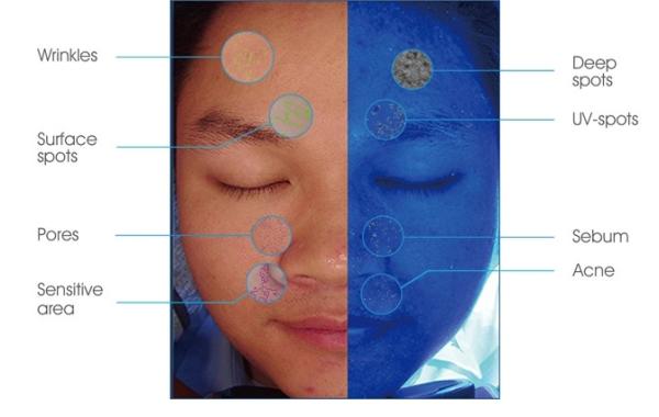 Buy Support External Printer Skin Analysis System With Android 8.1 Operating Platform at wholesale prices