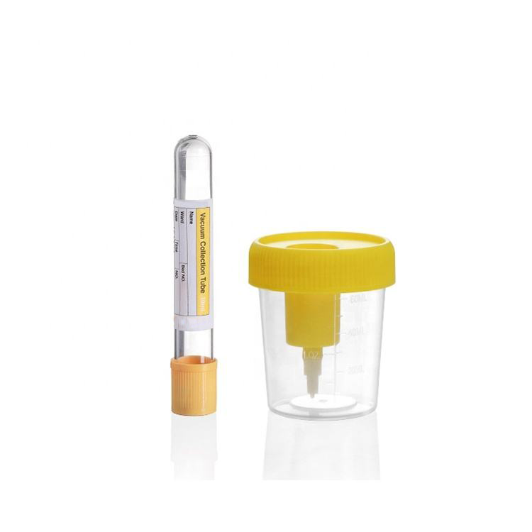 China Disposable Urine Cup with Needle Vacuum Urine Specimen Collection Cup 60ml 90ml 100ml 120ml with Needle on sale
