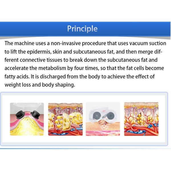 Vacuum Roller Cellulite Reduction Machine , Slimming Body Contouring Machine