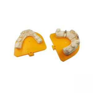 China High Strength Yellow Gold Porcelain Dental Crown PFM Ceramic Crown on sale