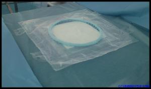 Quality C-Section Fluid Collection Pouch Surgical Incision Transparent PE Film for sale