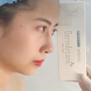 China Hyaluronic Acid Injection dermal fillers lip filler Breast Buttock Enhancement Anti Aging Dermal Filler on sale