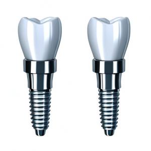 China Consistency In Every Crown Our Dental Implant Crown Manufacturing Process on sale