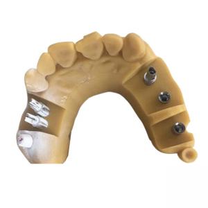 Quality Digital Biocompatibility PFM Dental Crown 3D Printing Temporary Crowns for sale