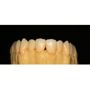 Buy cheap Dental Lab Fixed Prosthetics Layered Zirconia Dental Crown For Front Teeth from wholesalers