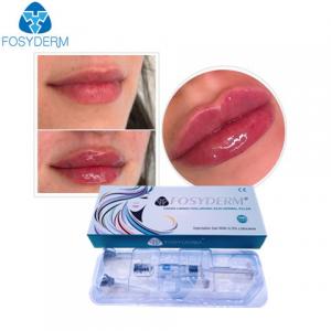 China Fosyderm Hyaluronic Acid Gel Anti Facial Wrinkles Dermal Fillers Injection on sale