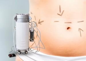 Quality Body Slimming Surgical Liposuction Machine For Clinic 12 Months Warranty for sale