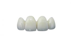Quality Highly Biocompatible Zirconia Dental Crown Less Sensitive Abrasion Resistance for sale