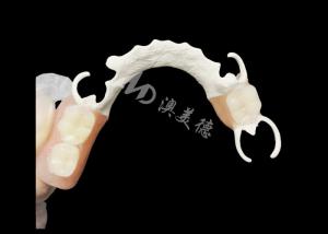 Quality Custom Cast Partial Denture with HPP framework for Enhanced Chewing and Speech for sale
