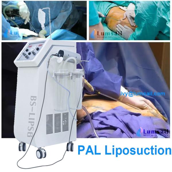 PAL Liposuction Fat Loss Device For Plastic Surgery Clinic