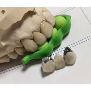 Buy cheap Porcelain CAD CAM PFM Crown from wholesalers